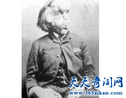 Joseph Merrick1.jpg