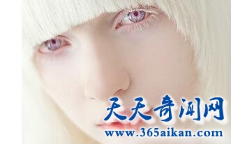 90后白化病女孩2.jpg