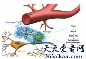 细数世界上九大难以诊断的神秘疾病是哪些？世界上九大难以诊断的神秘疾病介绍