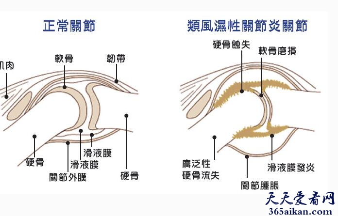 世界五大绝症是什么？世界五大绝症介绍