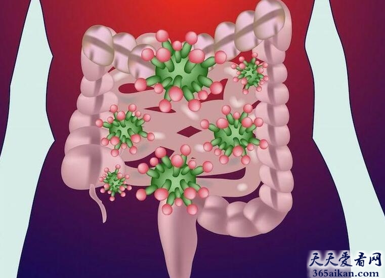 粪便微生物移植.jpg