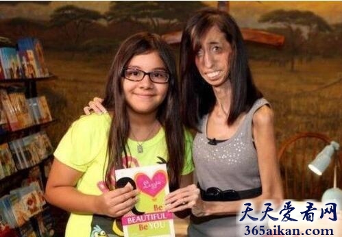 Lizzie Velasquez.jpg